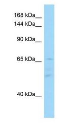 IL16 / IL-16 antibody Western Blot of Fetal Spleen.