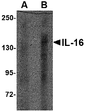 Western blot of IL-16 in rat brain tissue lysate with IL-16 antibody at (A) 1 ug/ml and (B) 2 ug/ml