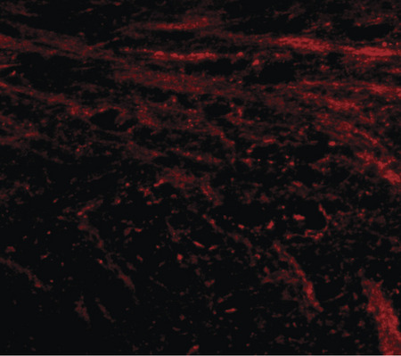 Immunofluorescence of IL-16 in mouse brain tissue with IL-16 antibody at 20 ug/ml.