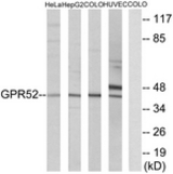 Western blot of extracts from COLO/HUVEC/HeLa/HepG2 cells, using GPR52 Antibody. The lane on the right is treated with the synthesized peptide.
