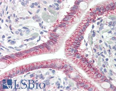 Anti-GPR52 antibody IHC staining of human small intestine. Immunohistochemistry of formalin-fixed, paraffin-embedded tissue after heat-induced antigen retrieval.