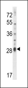 IL17D Antibody western blot of NCI-H460 cell line lysates (35 ug/lane). The IL17D antibody detected the IL17D protein (arrow).