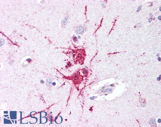 Anti-GPR52 antibody LS-A445 IHC of human putamen, neurons and glia. Immunohistochemistry of formalin-fixed, paraffin-embedded tissue after heat-induced antigen retrieval.