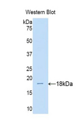 Western blot of recombinant IL17RA.