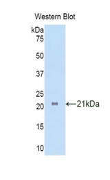 Western blot of recombinant IL17RA.