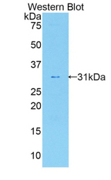 Western blot of recombinant IL17RA.