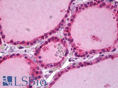 Anti-IL17RA / IL-17RA antibody IHC of human thyroid. Immunohistochemistry of formalin-fixed, paraffin-embedded tissue after heat-induced antigen retrieval. Antibody LS-B6868 concentration 5 ug/ml.