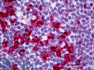 Anti-IL17RA / IL-17RA antibody IHC of human tonsil. Immunohistochemistry of formalin-fixed, paraffin-embedded tissue after heat-induced antigen retrieval. Antibody LS-B6706 dilution 1:50.