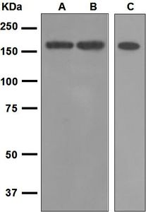 Western blot analysis on (A) HeLa, (B) Raji, and (C) RAW264.7 cell lysates using anti-IL-17R alpha antibody.