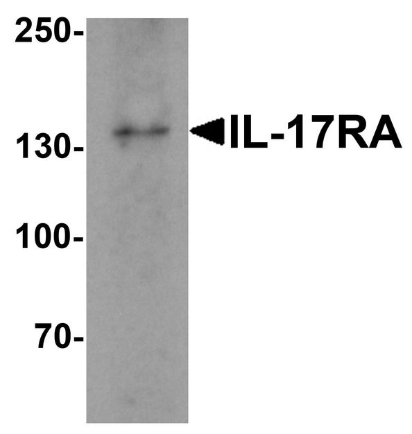 Western blot analysis of IL17RA in A20 cell lysate with IL17RA antibody at 1 ug/ml.
