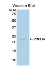 Western blot of recombinant IL17RB.