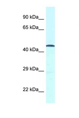 GPR52 antibody LS-C145962 Western blot of Fetal Heart lysate. Antibody concentration 1 ug/ml.