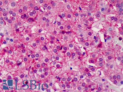 Anti-IL17RB / IL17B Receptor antibody IHC of human adrenal. Immunohistochemistry of formalin-fixed, paraffin-embedded tissue after heat-induced antigen retrieval. Antibody LS-B2044 concentration 5 ug/ml.