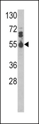 Western blot of IL17RB Antibody in MDA-MB468 cell line lysates (35 ug/lane). IL17RB (arrow) was detected using the purified antibody.