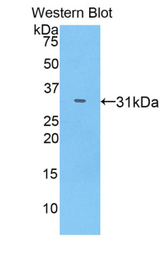 Western blot of recombinant IL17RC.