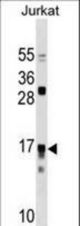 IL17RC Antibody western blot of Jurkat cell line lysates (35 ug/lane). The IL17RC antibody detected the IL17RC protein (arrow).