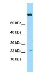 IL19 / IL-19 antibody Western Blot of Placenta.