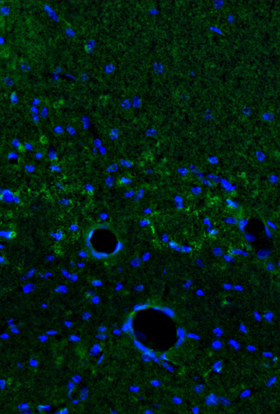 IHC of IL1A / IL1 Alpha antibody LS-C104666