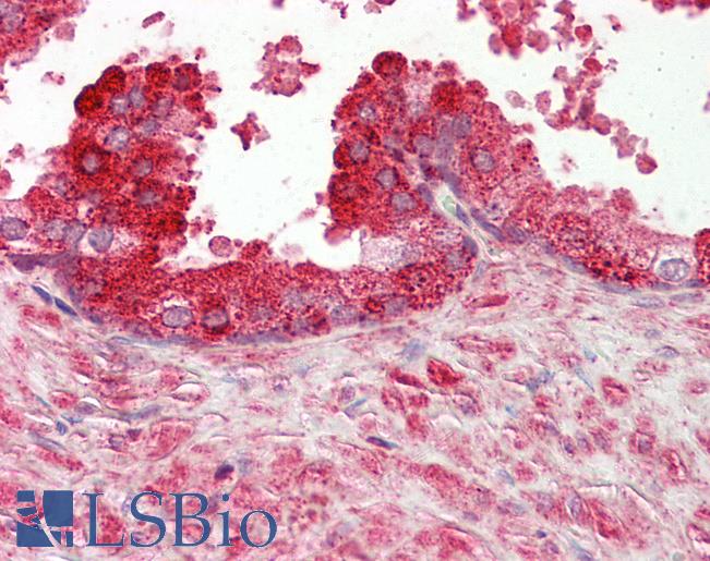 Anti-GPR55 antibody IHC staining of human prostate. Immunohistochemistry of formalin-fixed, paraffin-embedded tissue after heat-induced antigen retrieval.