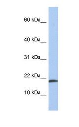 Fetal liver lysate. Antibody concentration: 1.0 ug/ml. Gel concentration: 10-20%.