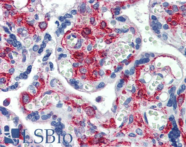 Anti-GPR6 antibody IHC of human placenta. Immunohistochemistry of formalin-fixed, paraffin-embedded tissue after heat-induced antigen retrieval. Antibody LS-B3988 concentration 5 ug/ml.