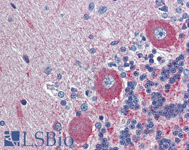 Anti-GPR6 antibody IHC of human brain, cerebellum. Immunohistochemistry of formalin-fixed, paraffin-embedded tissue after heat-induced antigen retrieval. Antibody LS-B3988 concentration 5 ug/ml.
