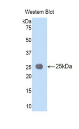 Western blot of recombinant IL-1RAcP / IL1RAP.