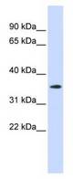 Western blot of placenta lysate.
