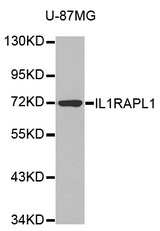 Western blot analysis of extracts of various cell lines, using IL1RAPL1 antibody.