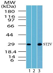 Western blot of ST2V in Daudi cell lysate in the 1) absence and 2) presence of immunizing peptide and 3) NIH 3T3 using LS-C148350 at 5 ug/ml and 3 ug/ml, respectively.