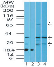 Western blot of ST2 protein in human kidney lysate in the 1) absence and 2) presence of immunizing peptide, 3) mouse kidney and 4) rat kidney lysate using LS-C148536 at 4.0 ug/ml. Goat anti-rabbit Ig HRP secondary antibody, and PicoTect ECL substrate solution, were used for this test.
