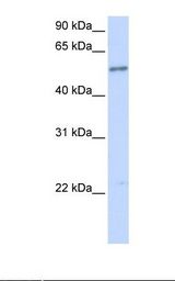 Fetal brain lysate. Antibody concentration: 1.0 ug/ml. Gel concentration: 12%.
