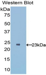 Western blot of recombinant IL1RL1 / ST2.