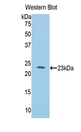 Western blot of recombinant IL1RL1 / ST2.