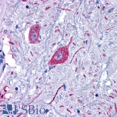 Anti-GPR6 antibody LS-A169 IHC of human brain, neurons and glia. Immunohistochemistry of formalin-fixed, paraffin-embedded tissue after heat-induced antigen retrieval.