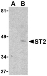 Western blot of ST2 in mouse kidney lysate with ST2 antibody at 1 ug/ml in the presence (lane A) or absence (lane B) of 1 ug blocking peptide.