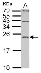 IL1 Receptor antagonist antibody detects IL1RN protein by Western blot analysis. A. 30 ug PC-12 whole cell lysate/extract. 15 % SDS-PAGE. IL1 Receptor antagonist antibody dilution:1:1000