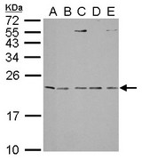 IL1 Receptor antagonist antibody detects IL1RN protein by Western blot analysis. A. 30 ug Neuro2A whole lysate/extract. B. 30 ug C8D30 whole cell lysate/extract. C. 30 ug NIH-3T3 whole cell lysate/extract. D. 30 ug Raw264.7 whole cell lysate/extract. E. 30 ug C2C12 whole cell lysate/extract. 15 % SDS-PAGE. IL1 Receptor antagonist antibody dilution:1:1000