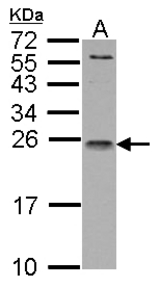IL1 Receptor antagonist antibody detects IL1RN protein by Western blot analysis. A. 30 ug Raji whole cell lysate/extract. 15 % SDS-PAGE. IL1 Receptor antagonist antibody dilution:1:1000