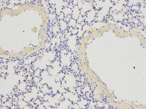 Immunohistochemistry of paraffin-embedded rat pancreas using IL1RN antibody at dilution of 1:200 (400x lens).