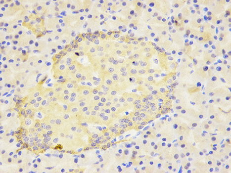Immunohistochemistry of paraffin-embedded mouse lung using IL1RN antibody at dilution of 1:200 (200x lens).