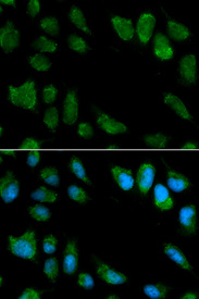 Immunofluorescence analysis of MCF7 cell using IL1RN antibody. Blue: DAPI for nuclear staining.