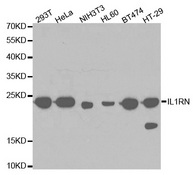 Western blot analysis of extracts of various cell lines, using IL1RN antibody.