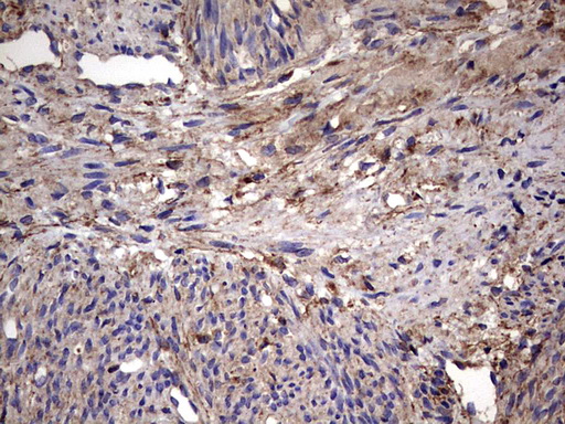 IHC of paraffin-embedded Human endometrium tissue using anti-IL1RN mouse monoclonal antibody. (Heat-induced epitope retrieval by 1 mM EDTA in 10mM Tris, pH8.5, 120°C for 3min).