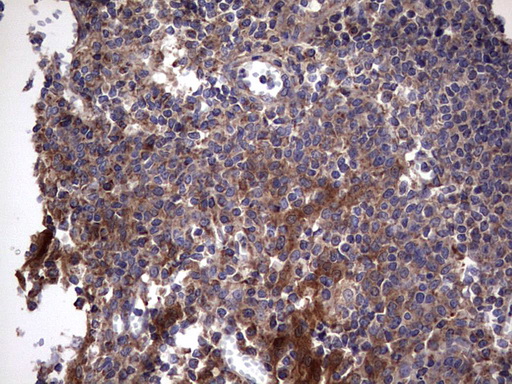 IHC of paraffin-embedded Human tonsil using anti-IL1RN mouse monoclonal antibody. (Heat-induced epitope retrieval by 1 mM EDTA in 10mM Tris, pH8.5, 120°C for 3min).
