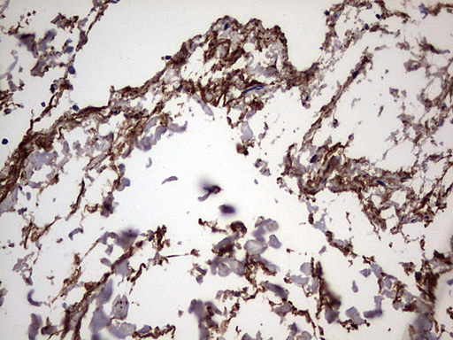 IHC of paraffin-embedded Human thyroid tissue using anti-IL1RN mouse monoclonal antibody. (Heat-induced epitope retrieval by 1 mM EDTA in 10mM Tris, pH8.5, 120°C for 3min).