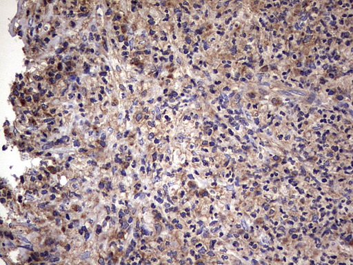 IHC of paraffin-embedded Human lymph node tissue using anti-IL1RN mouse monoclonal antibody. (Heat-induced epitope retrieval by 1 mM EDTA in 10mM Tris, pH8.5, 120°C for 3min).