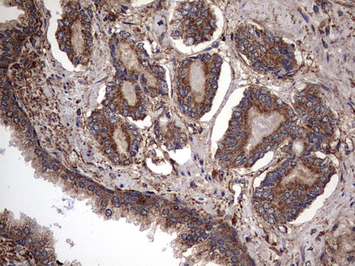 IHC of paraffin-embedded Human prostate tissue using anti-IL1RN mouse monoclonal antibody. (Heat-induced epitope retrieval by 1 mM EDTA in 10mM Tris, pH8.5, 120°C for 3min).