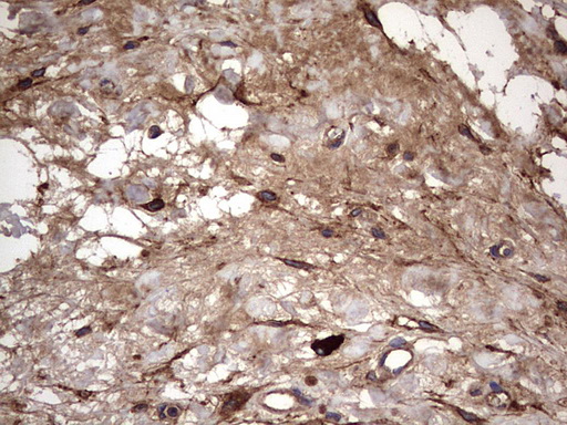 IHC of paraffin-embedded Human bladder tissue using anti-IL1RN mouse monoclonal antibody. (Heat-induced epitope retrieval by 1 mM EDTA in 10mM Tris, pH8.5, 120°C for 3min).