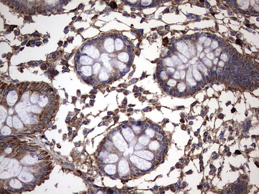 IHC of paraffin-embedded Human colon tissue using anti-IL1RN mouse monoclonal antibody. (Heat-induced epitope retrieval by 1 mM EDTA in 10mM Tris, pH8.5, 120°C for 3min).
